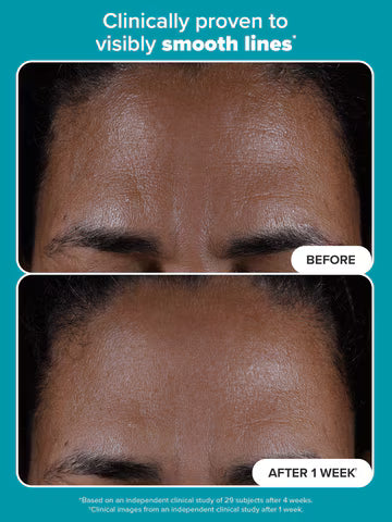 Paula's Choice Skincare 2% BHA Liquid Exfoliant